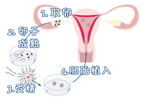 爱心同性供卵代孕微信群